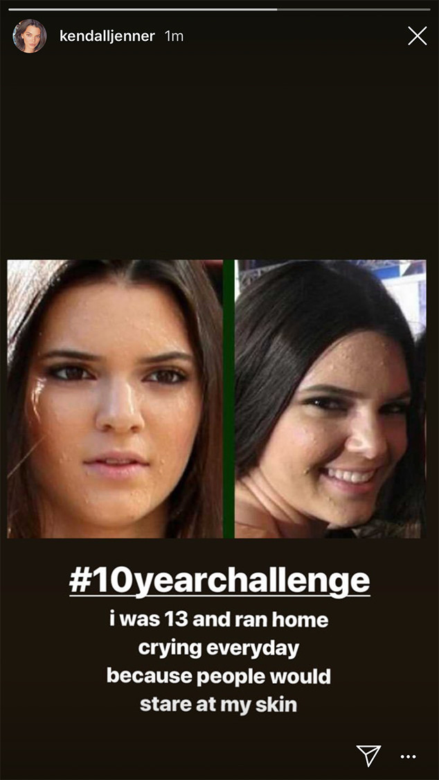 Kendall Jenner Kendall Jenner